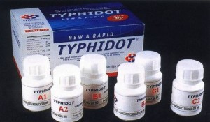 Typhoid Test